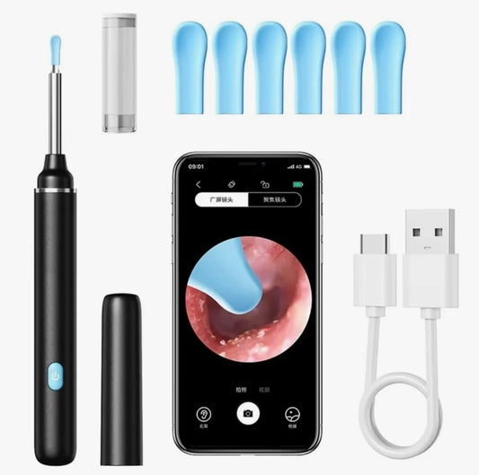 SmartVue Ear Cleaner — HD Camera Ear Wax Removal Tool