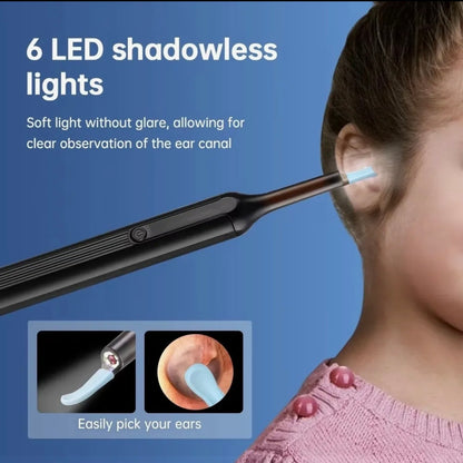SmartVue Ear Cleaner — HD Camera Ear Wax Removal Tool