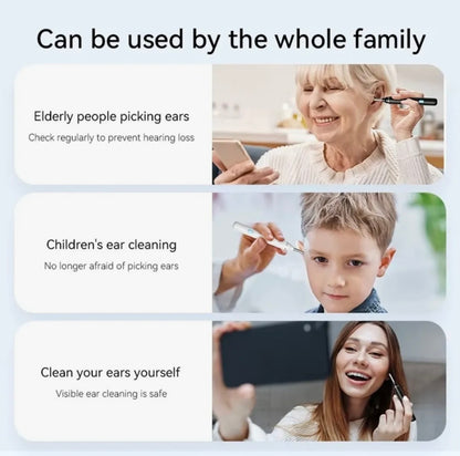 SmartVue Ear Cleaner — HD Camera Ear Wax Removal Tool